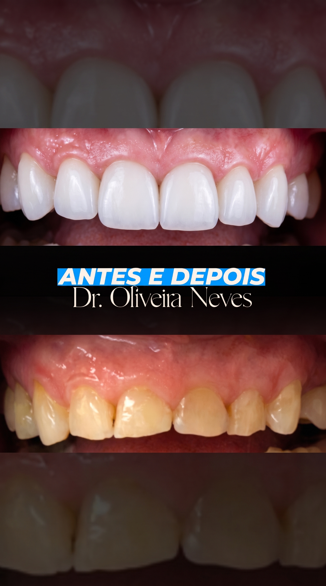 Antes e depois — caso clínico 4 · Dr. Oliveira Neves