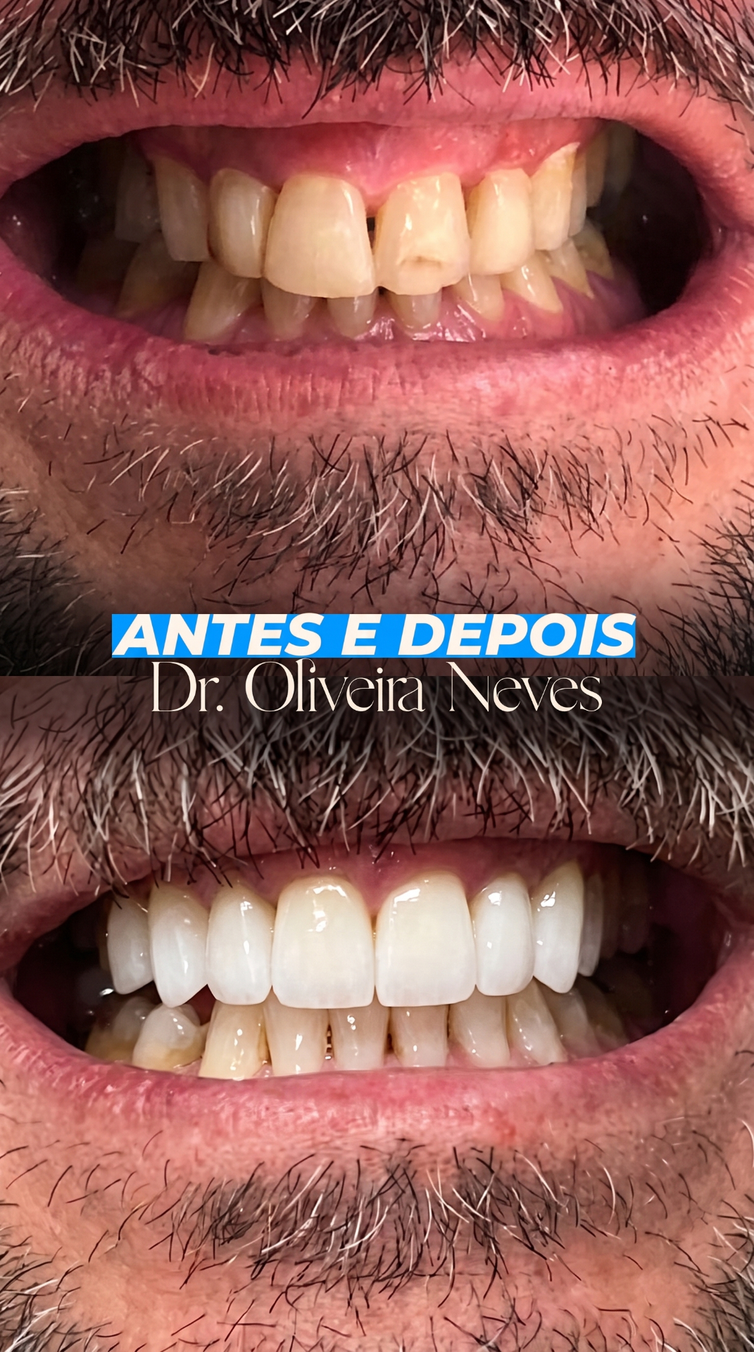 Antes e depois — caso clínico 3 · Dr. Oliveira Neves
